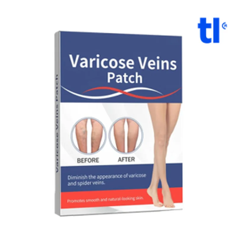 Varicose Veins